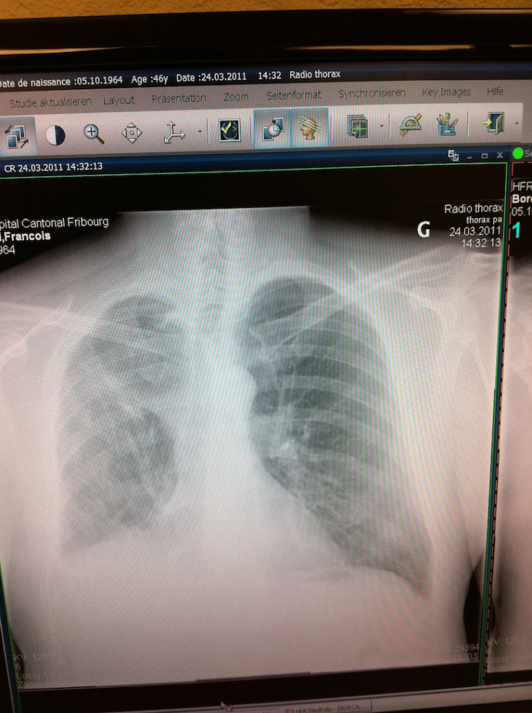 Radio_poumon_mars_2011