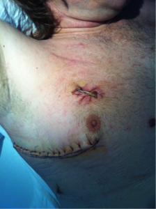 Après la totalisation...